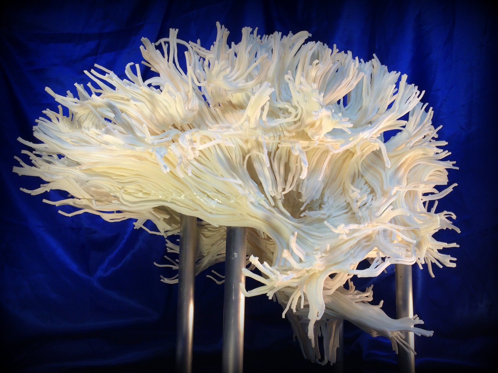 A 3-D brain image