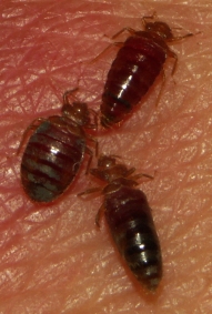 Three bedbugs on human skin. 