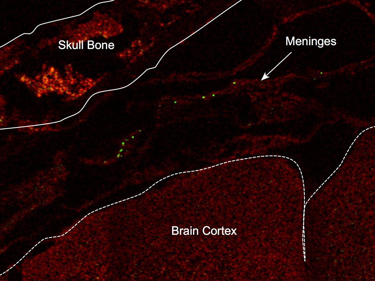 Meninges in mouse brain