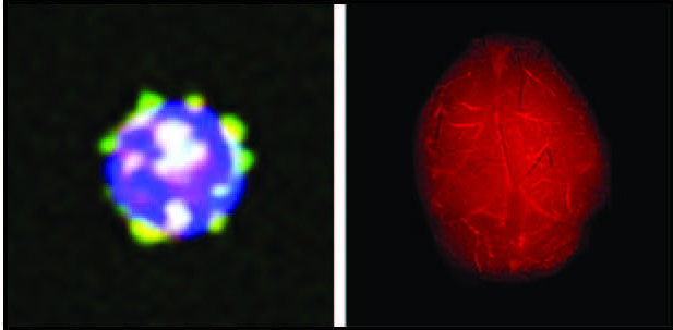 Left: T and B cells are types of white blood cells that develop from stem cells (progenitor cells) in the bone marrow. When HDL (good cholesterol) containing the protein ApoM (in yellow) binds to the surface of their progenitor cells, it prevents them from proliferating. Right: Mice that lack the ApoM protein on their HDL develop more severe brain inflammation in a mouse model of multiple sclerosis. This inflammation is illustrated by leakage of a red fluorescent dye from blood vessels into the brain. Image