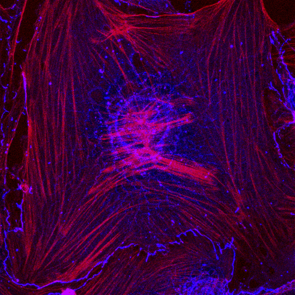 stress fibers in endothelial cells lining cerebral blood vessels