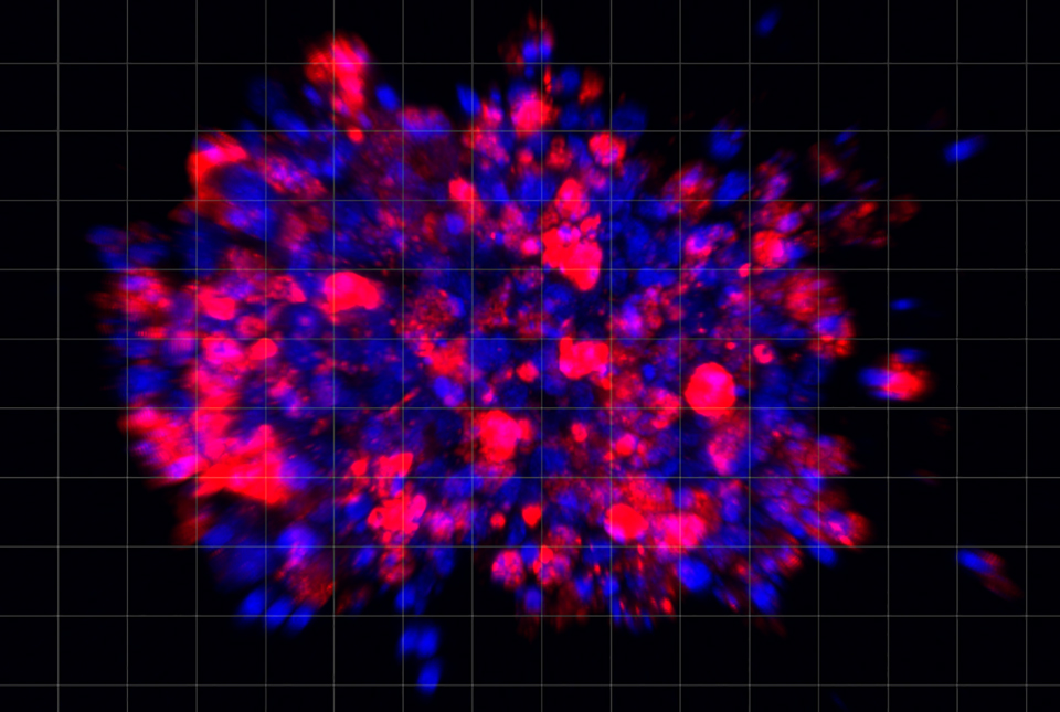 Scientists use organoid model to identify potential new pancreatic