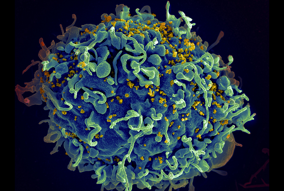 New Lab Test to Detect Persistent HIV Strains in Africa May Aid Search ...