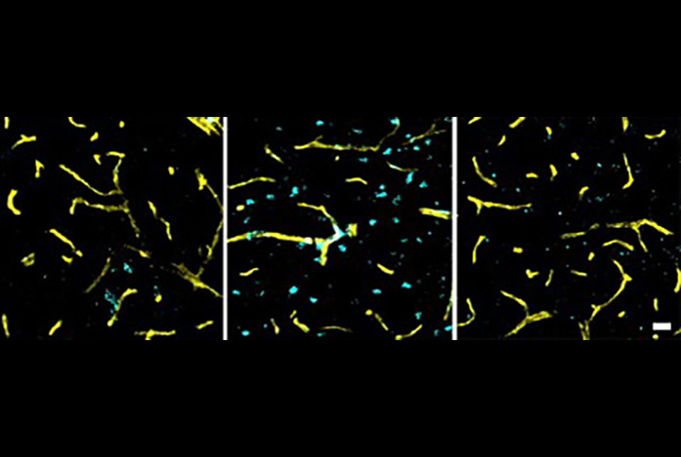news.weill.cornell.edu image