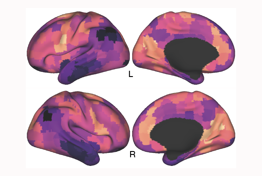 Structural And Functional Alignment In The Brain Linked To Age Sex And Cognition Newsroom 6136