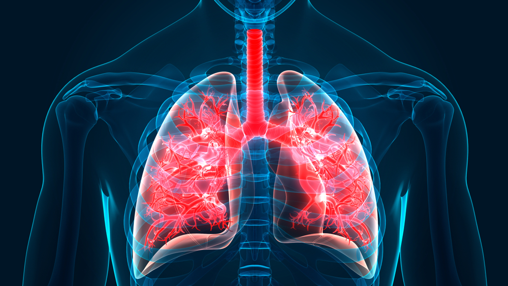 A Step Closer To Understanding Idiopathic Pulmonary Fibrosis Newsroom