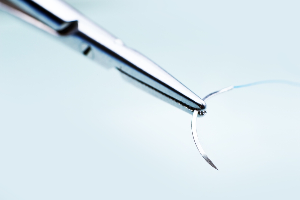Dissolvable Device Could Make Closing Surgical Incisions a Cinch