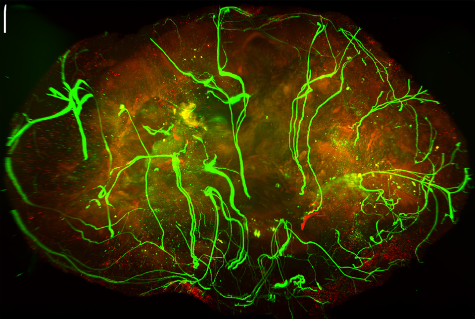 news.weill.cornell.edu image