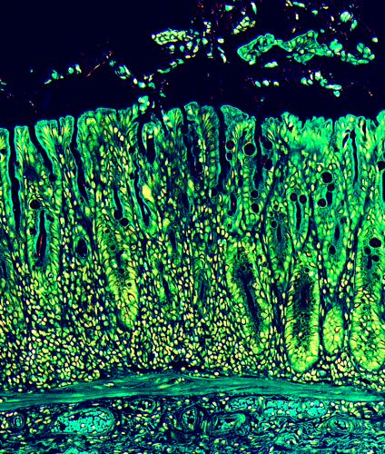 Microscopic image of an inflamed mouse intestine