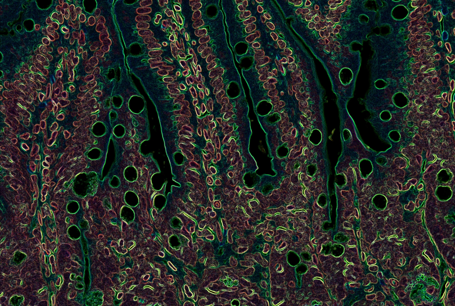 mouse intestine