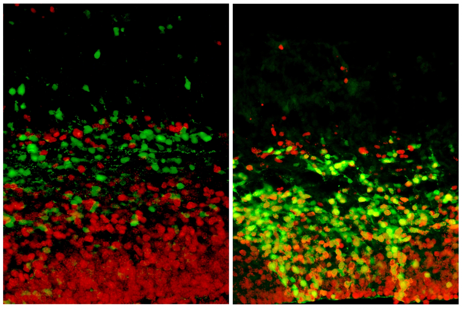 embryonic mouse brain