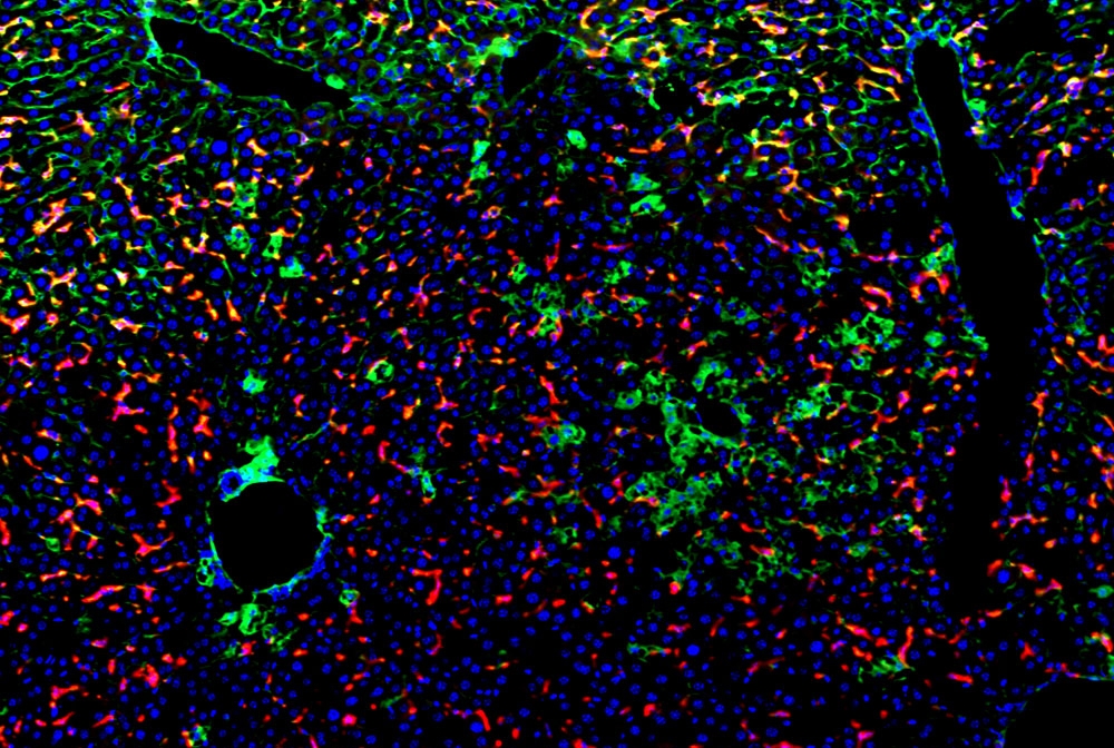MIF-expressing pancreatic cancer exosomes induce/prepare liver metastasis. Pancreatic cancer exosomes induce liver fibrosis (fibronectin, green) and immune cells (macrophages, red) accumulate. Image credit: Dr. Bruno Costa da Silva and Dr. David Lyden  