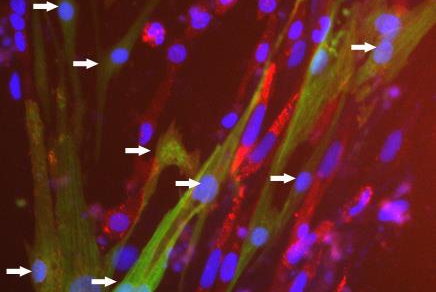 rare cells in heart chambers