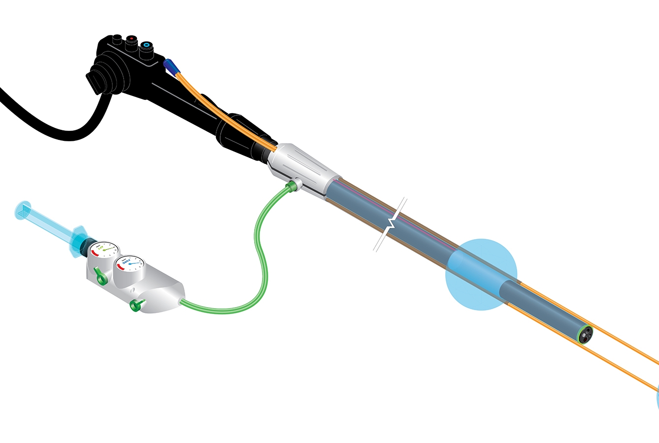 Endolumenal Surgical Platform