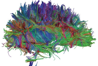 The book cover of Dr. Joseph Fins' new book, "Rights Come to Mind: Brain Injury, Ethics, and the Struggle for Consciousness."  Image: Cambridge University Press
