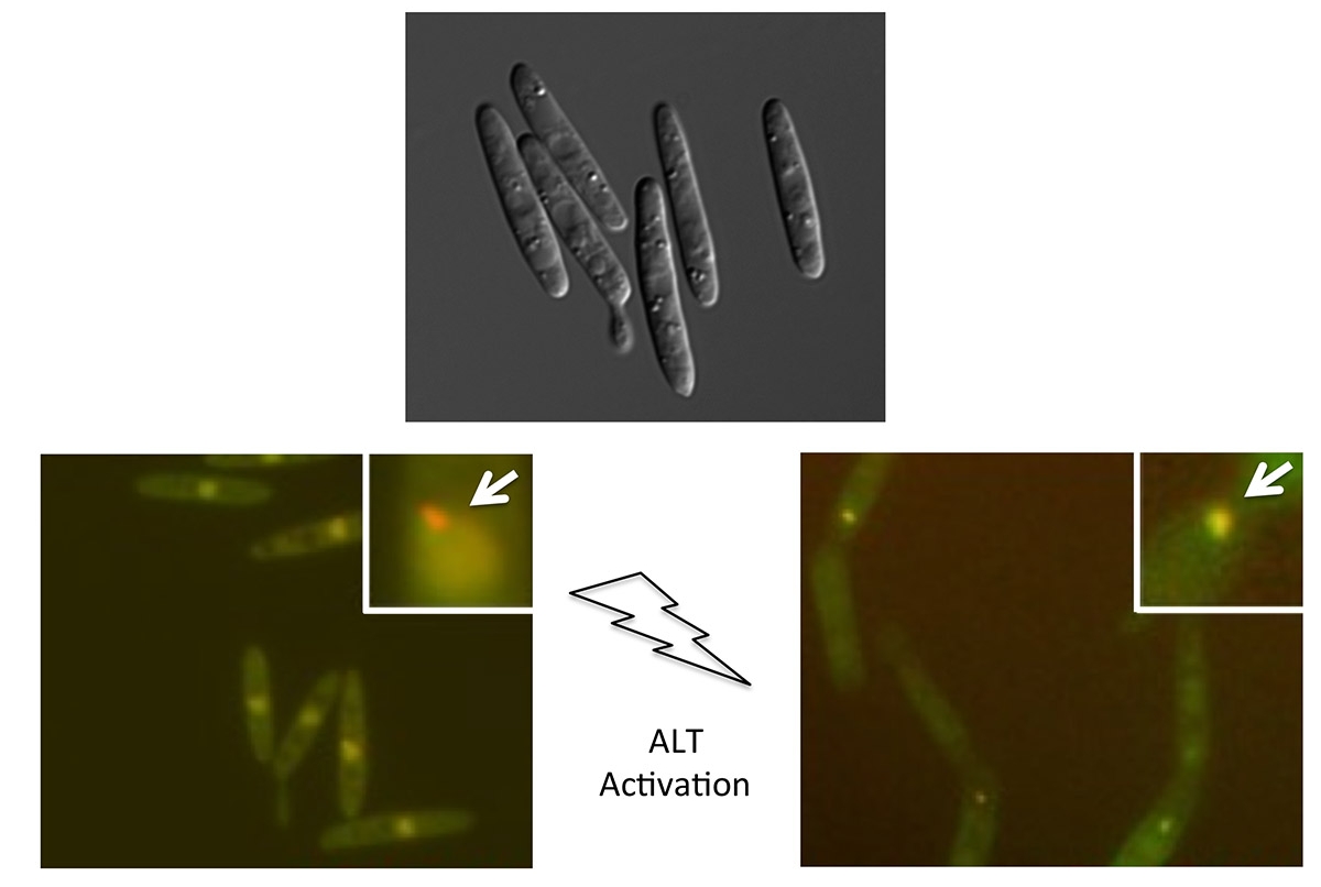 The top panel shows a Nomarski microscopic image of Ustilago maydis, the model organism used to study the ALT pathway that some cancer cells rely on to replenish telomeres. The bottom panels are fluorescent live cell images of U. maydis cells before and after the activation of the ALT pathway. When the pathway is triggered, Mre11 molecules (attached to green fluorescent dyes) form clusters at telomeres, converting the orange-colored telomere cluster to yellow (marked by white arrows).  Image: Lue Lab