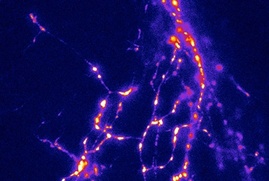 Fluorescence signals from vGlut1- pHluorin, a synaptic vesicle exocytosis biosensor, expressed in rat hippocampal neurons after electrical stimulation. Image credit: Drs. Hugh Hemmings, Zhenyu Zhou and Daniel Cook