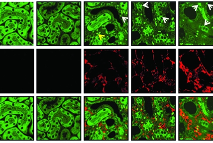 Organ damage: In a mouse model of a kidney fibrosis, epithelial cells show evidence of autophagy (the green spots marked by arrows), which was mounted as a defense against scarring (seen in red).