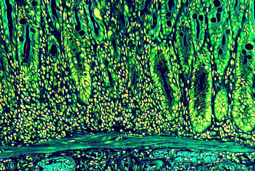 microscopic image of intestinal lining