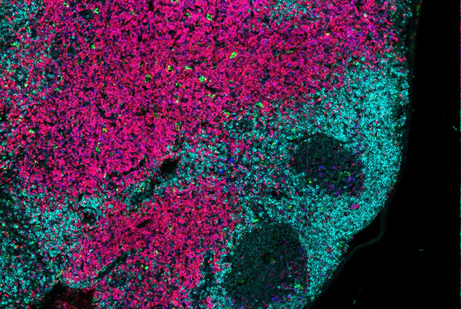 Visualizing innate lymphoid cells in the mouse lymph node: ILCs (green), B cells (cyan), T cells (magenta). Image courtesy of Dr. Saya Moriyama and Dr. David Artis