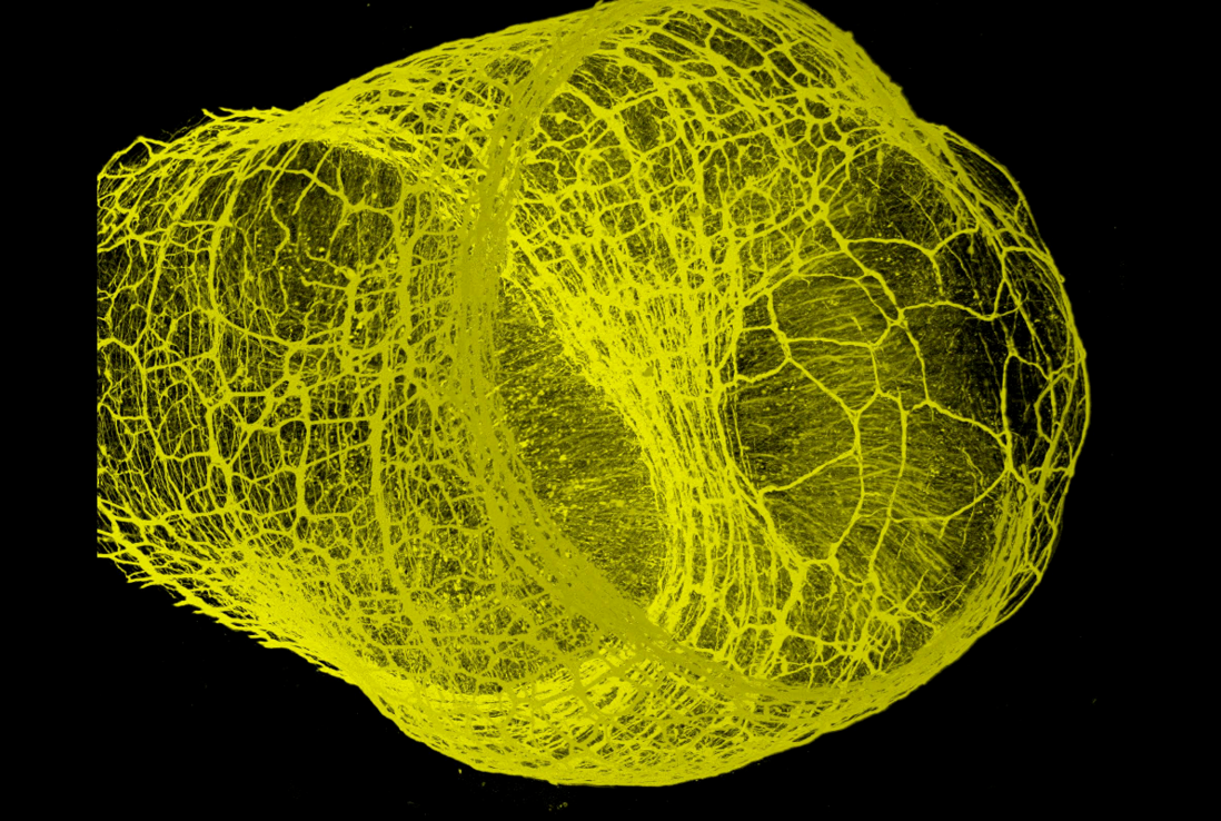 a yellow scientific image against a black backdrop