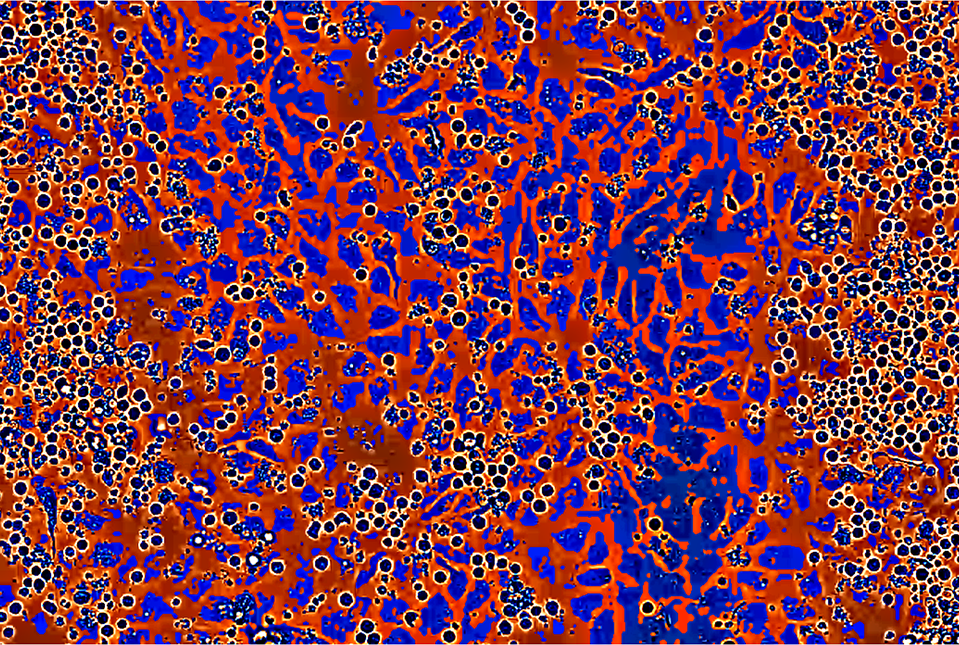 colorized greyscale image of blood cells expanding on top of vascular endothelial cells