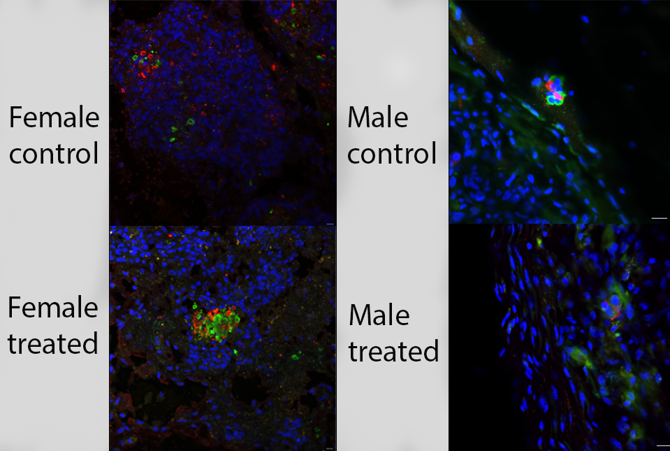 Small Molecule Treatment Could Make Islet Transplantation Therapy More Effective