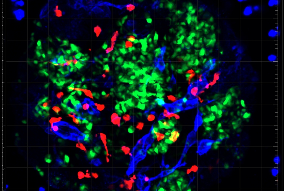 insulin stained green, immune cells stained red, vascular cells stained blue