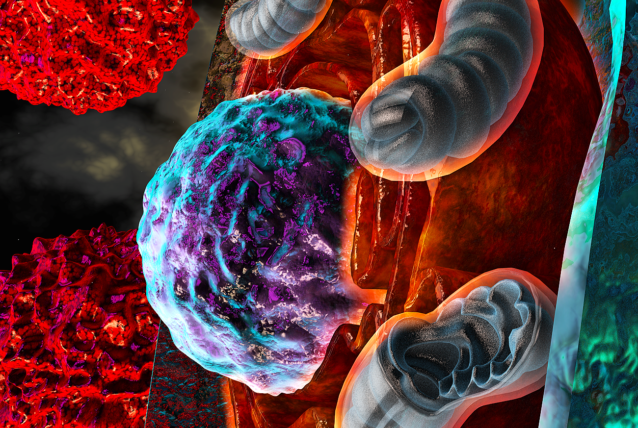 In this illustrated model, T cells afflicted by harsh conditions inside the tumor experience endoplasmic reticulum (ER) stress, symbolized here by the “burning” ER (orange) surrounding the nucleus (purple and turquoise). Severe ER stress responses driven by IRE1a-XBP1 pathway signaling alter the function of mitochondria (blue-gray) and consequently limit optimal T cell responses to cancer cells (red). 