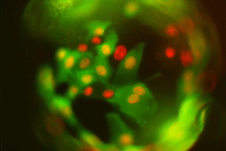 Organoid labeled with fluorescent green and red markers
