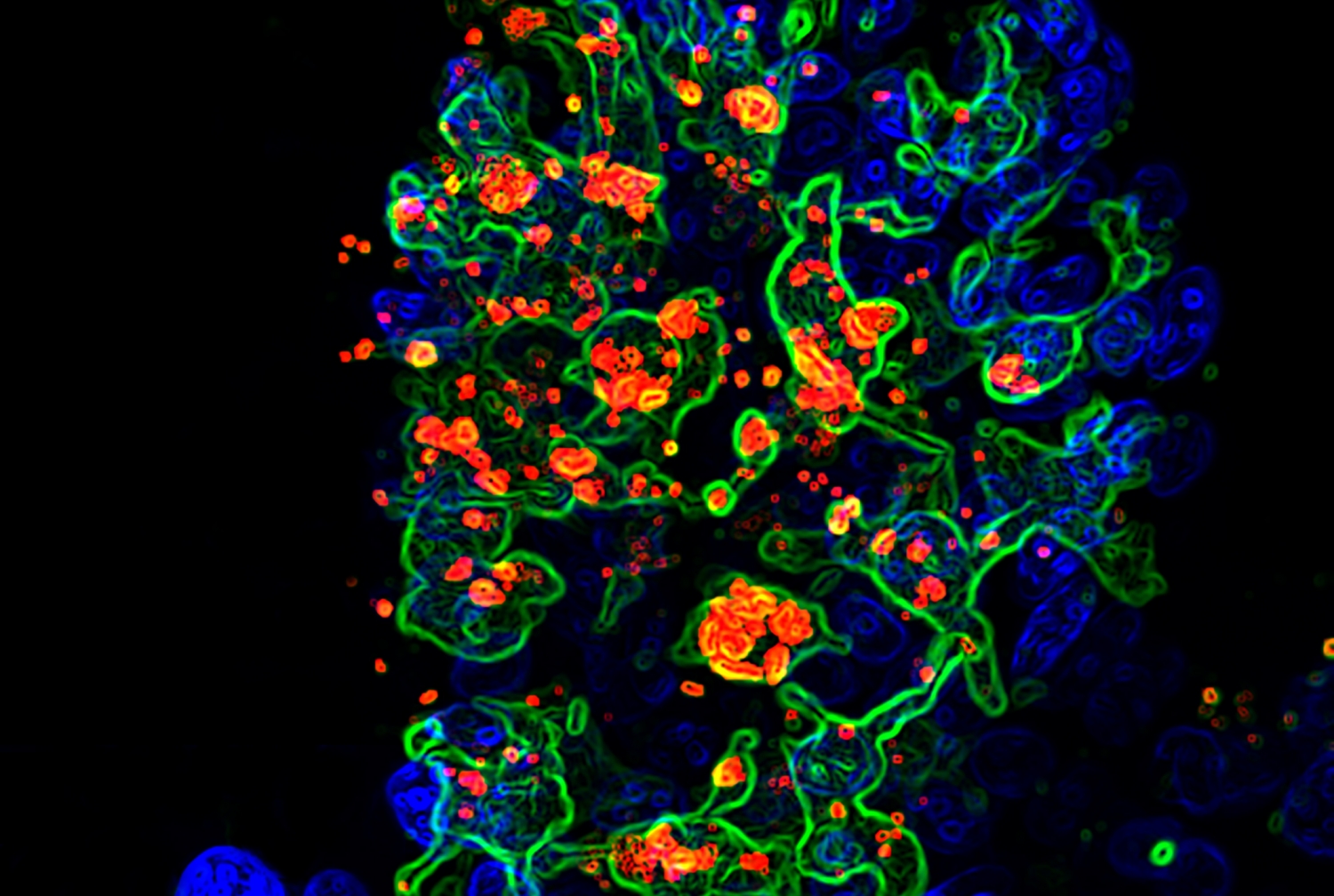 Opportunistic fungus called candida albicans (red) engulfed by CX3CR1+ phagocytes (green) in the gut villi (blue).Photo credit: Dr. Iliyan D. Iliev and Dr. Irina Leoanrdi. 
