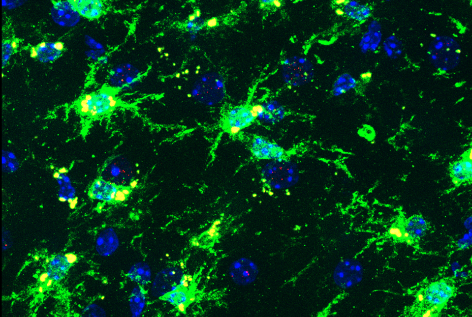 inflammatory microglia stained green and yellow