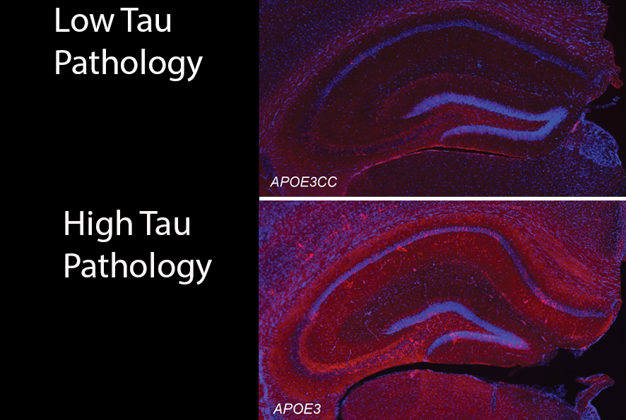 Immunofluorescent image of mouse hippocampus stained for tau