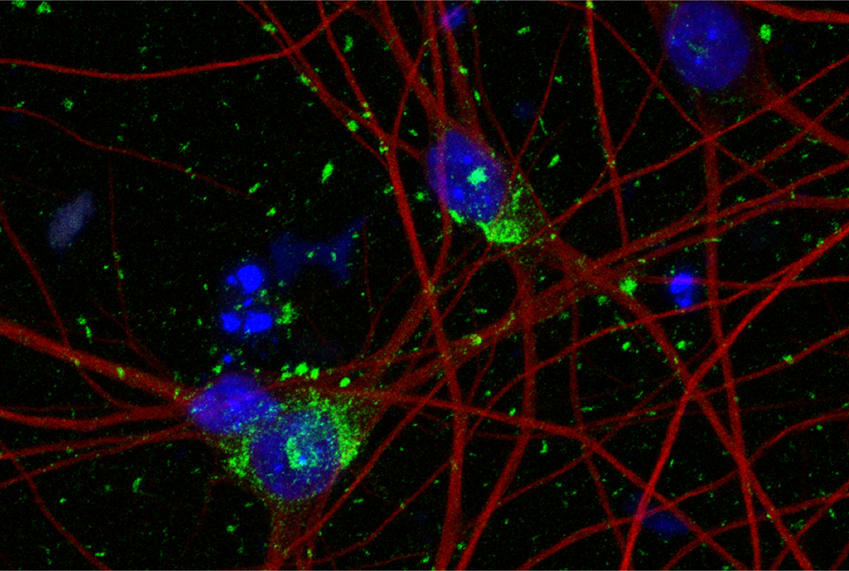 image showing cells stained blue, tau aggregates in green and neuron cytoskeleton in red