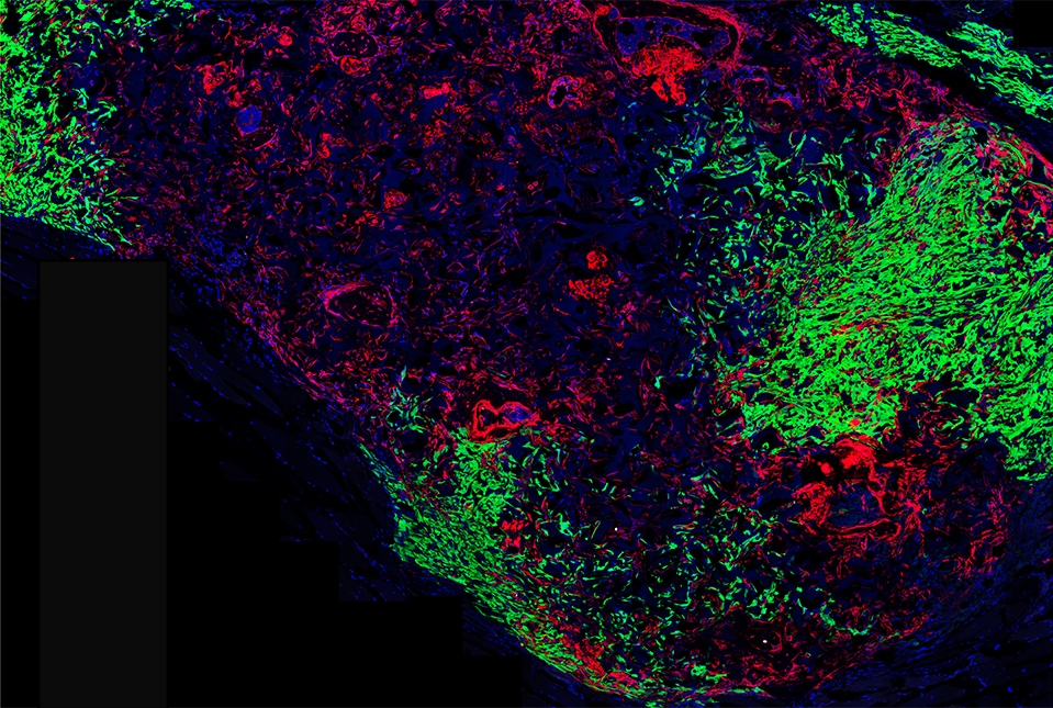 green and red labeled cells in immunofluorescent image