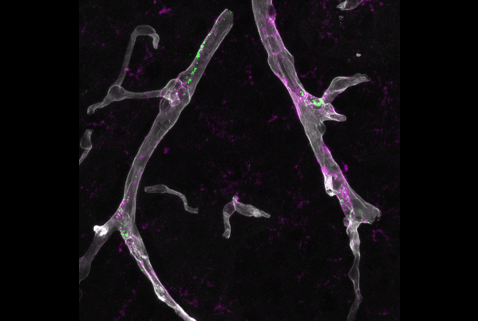 apoe4 vascular dammage