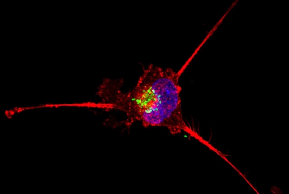 triple negative breast cancer