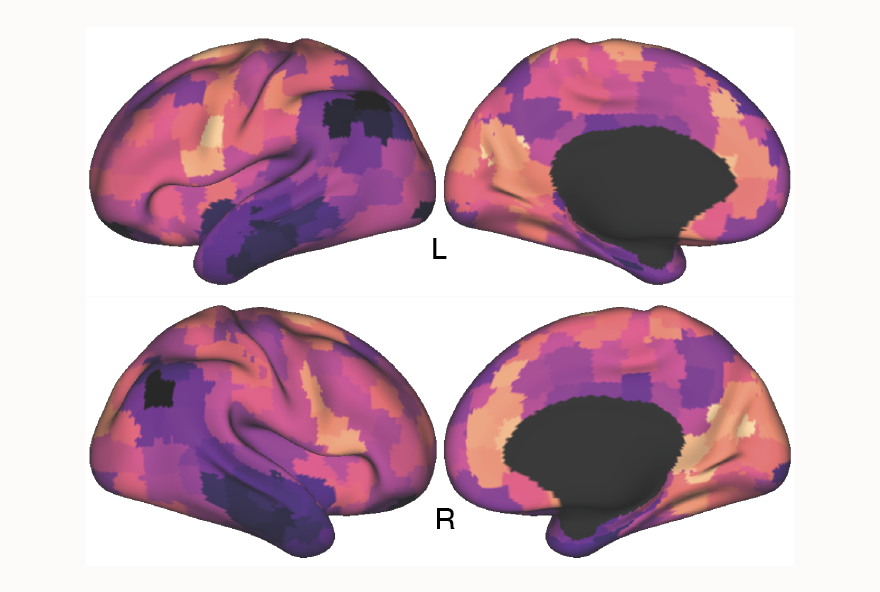 brain images with color waves