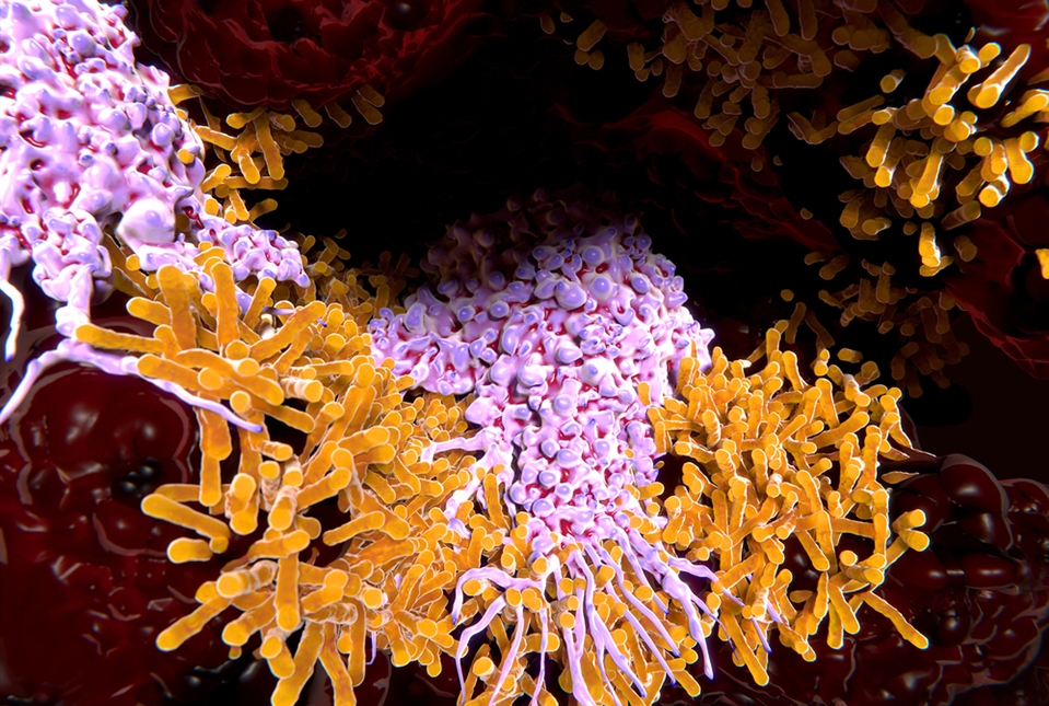 pink macrophages engulfing orange rodlike bacteria