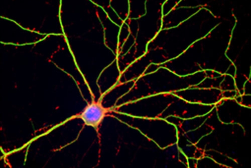 Hippocampal neuron