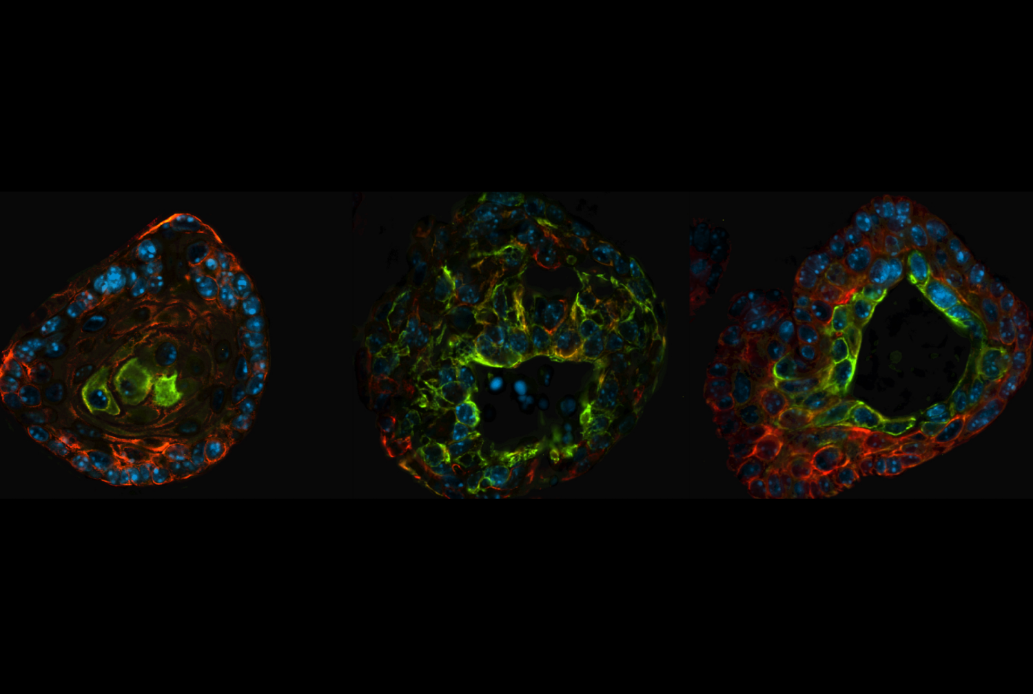 Prostate organoids from genetically engineered mouse models. Image credit: Mirjam Blattner and Dennis Huang