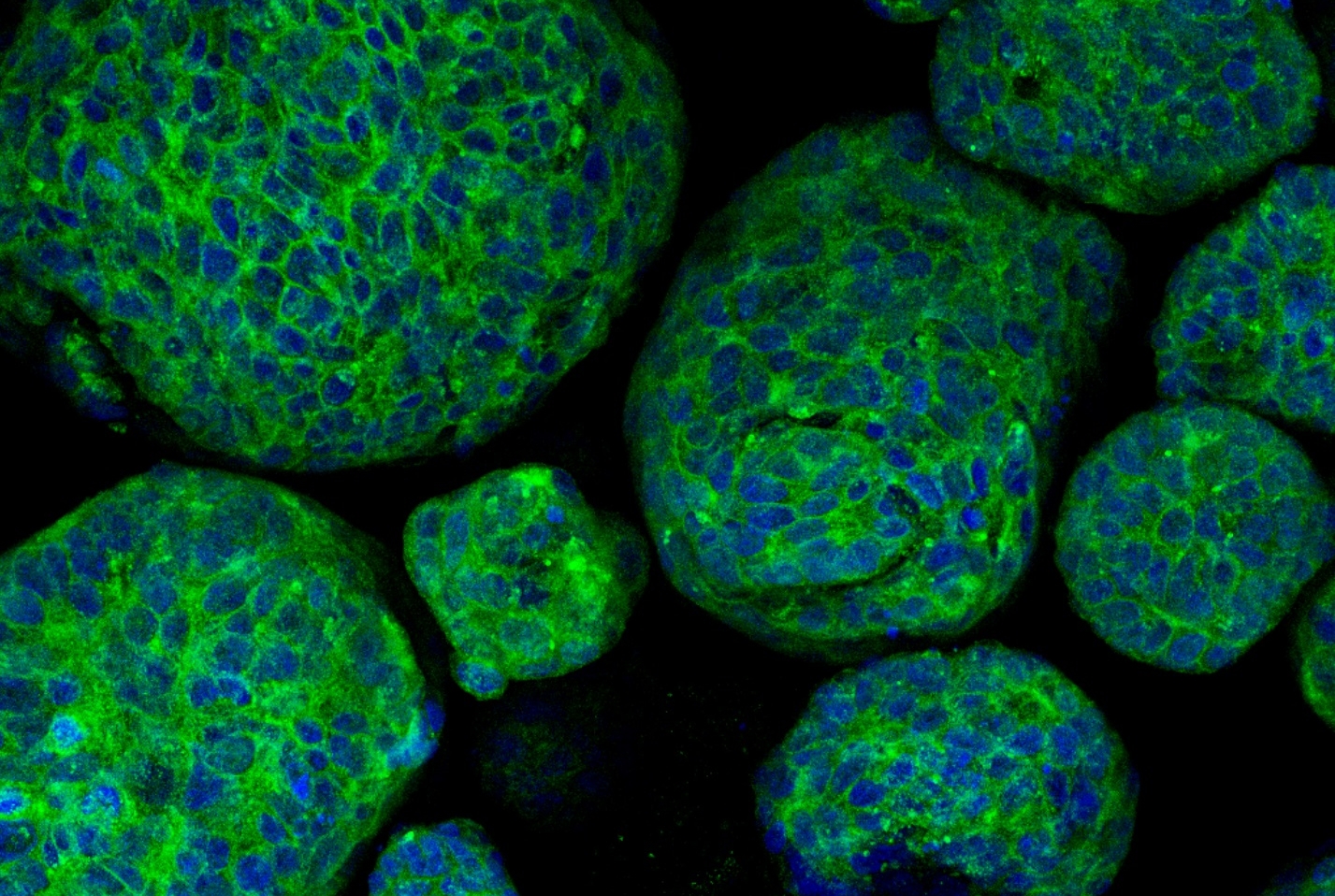 Image of prostate cancer organoids demonstrating expression of synaptophysin (stained in green), a marker protein for neuroendocrine cells.