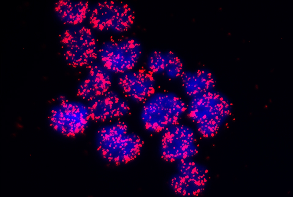 FOXO1 and p300 interaction demonstrated by red fluorescence.