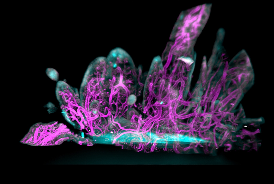 magenta and cyan stained tissue