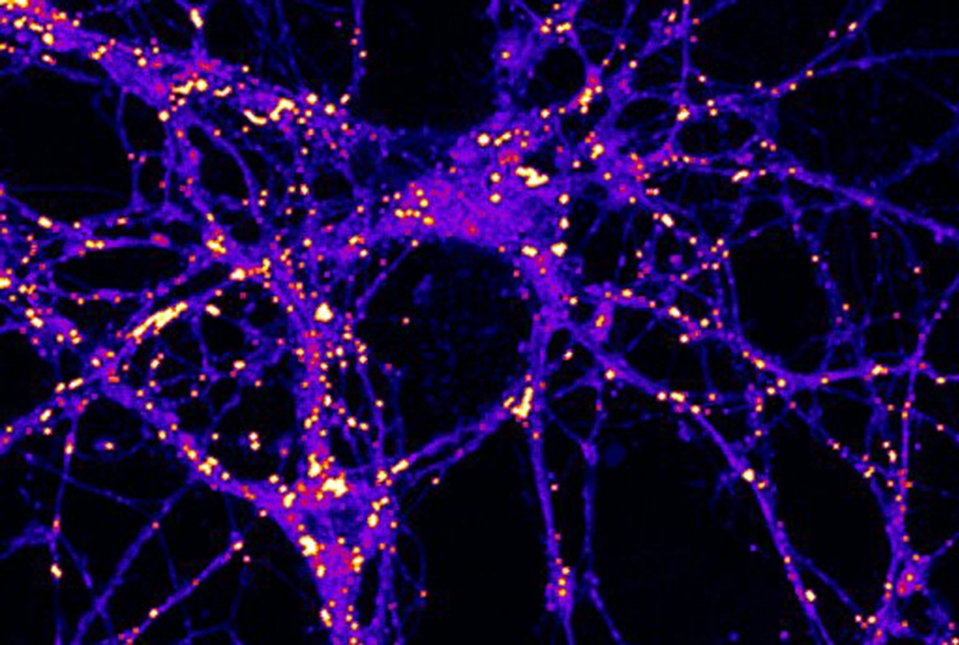 Fat May Play an Important Role in Brain Metabolism