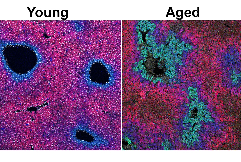 cells stained blue and purple