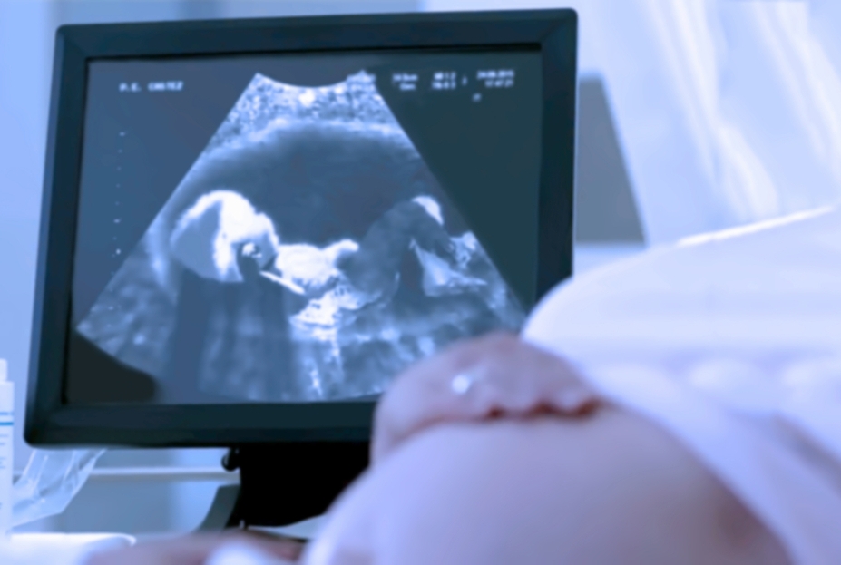 Pregnant woman having a ultrasound scan