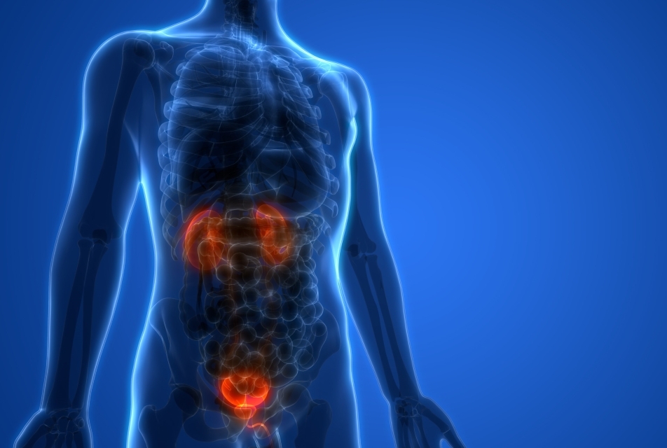 bladder cancer