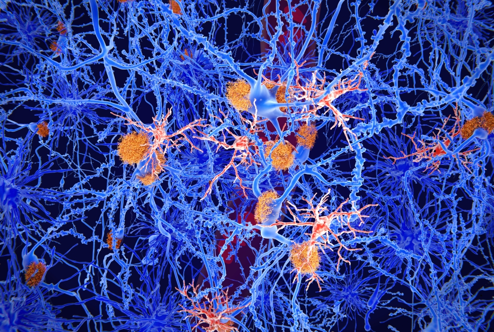 Reprogramming the Brain’s Cleaning Crew to Mop Up Alzheimer’s Disease