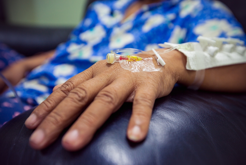 a patients hand with tubes inserted in them for chemotherapy
